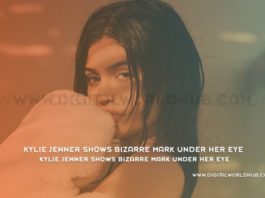 Kylie Jenner Shows Bizarre Mark Under Her Eye