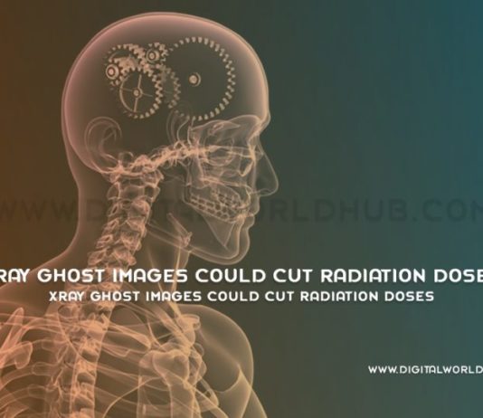 Xray Ghost Images Could Cut Radiation Doses
