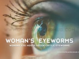 Womans Eye Hosts Dozen Cattle Eyeworms