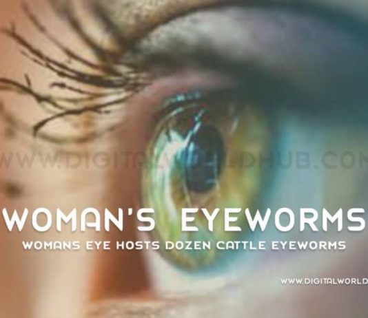 Womans Eye Hosts Dozen Cattle Eyeworms